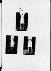 Go to image 160.