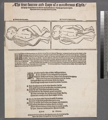 The true fourme and shape of a monsterous chyld, whiche was borne in Stony Stratforde, in North Hampton shire